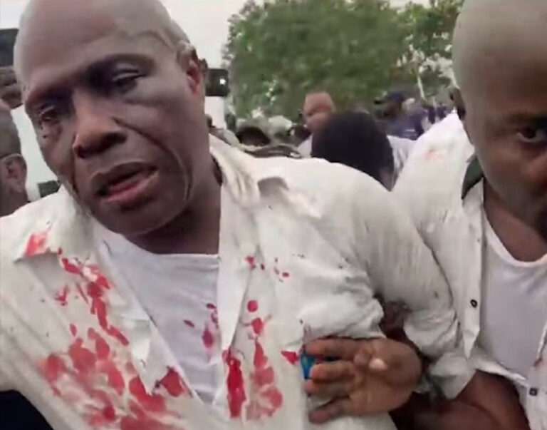 Rd Congo: Journée sous tension à Kinshasa, plusieurs leaders d&rsquo;opposition blessés.